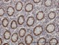 FOXA1 Antibody (monoclonal) (M03)